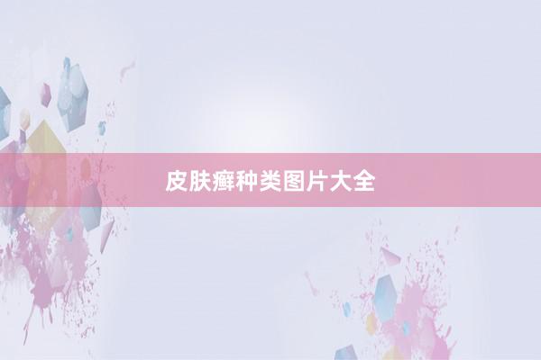 皮肤癣种类图片大全